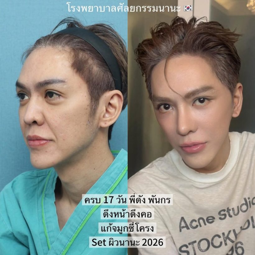 เห็นกันหรือยังหน้าใหม่ ดัง พันกร เป๊ะทุกจุดเต็มสิบไม่หัก