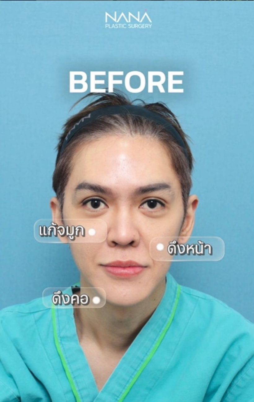เห็นกันหรือยังหน้าใหม่ ดัง พันกร เป๊ะทุกจุดเต็มสิบไม่หัก