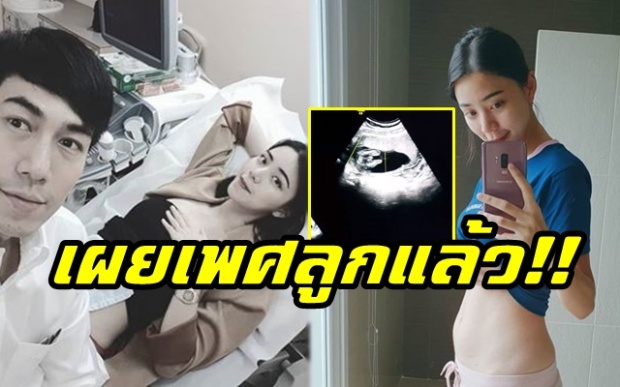 ดูกันชัดๆ “นิวเคลียร์” เผยผลอัลตราซาวด์เพศลูกแล้ว!! (มีคลิป)