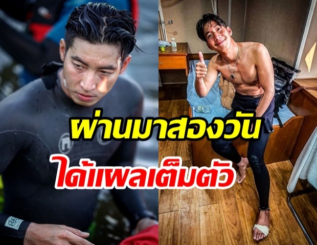 อัปเดตอาการ โตโน่ ว่ายข้ามเกาะ 2 วัน ร่างกายเป็นยังไงบ้าง 