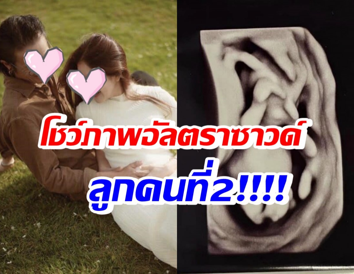 ว่าที่คุณพ่อสายร๊อคสุดปลื้ม โชว์ภาพอัลตราซาวด์ลูกคนที่2 