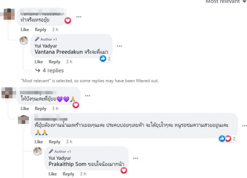 เห็นกันยังหน้าใหม่ ยุ้ย ญาติเยอะ ขึ้นเขียงศัลยกรรมสวยพุ่งมาแต่ไกล