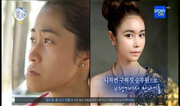 ครั้งแรกของสาวไทย! กับการร่วมรายการเรียลลิตี้ศัลยกรรมเปลี่ยนชีวิตของเกาหลี
