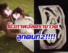 ว่าที่คุณพ่อสายร๊อคสุดปลื้ม โชว์ภาพอัลตราซาวด์ลูกคนที่2 