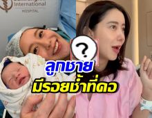 ไอซ์ อภิษฎา เผยสาเหตุรอยช้ำ ที่คอน้องโนอา หลังคลอด