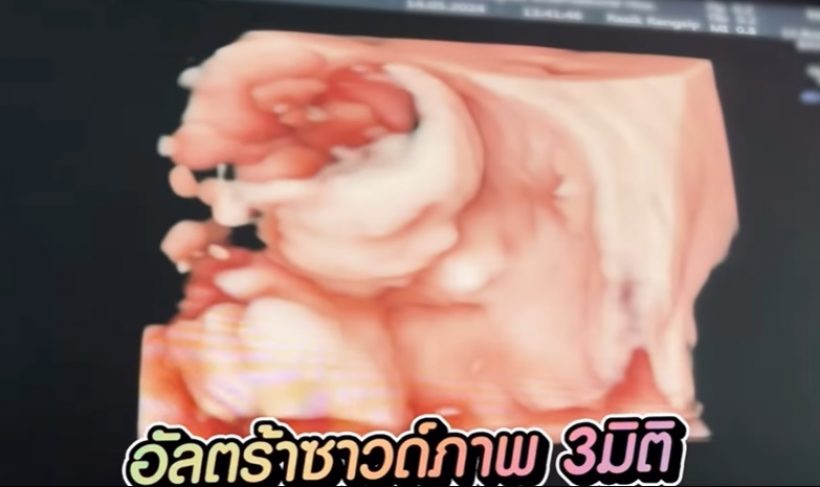 เปาวลีอวดพัฒนาการลูก5เดือน ตั้งชื่อไว้แล้วปู่กิ๊กเห่อหลานหนักมาก