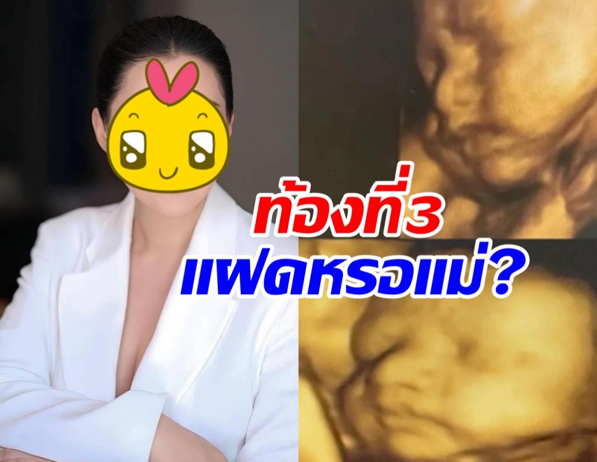 ชาวเน็ตตกใจภาพอัลตร้าซาวด์ลูกในท้อง ดาราดัง แฝดหรอ!?