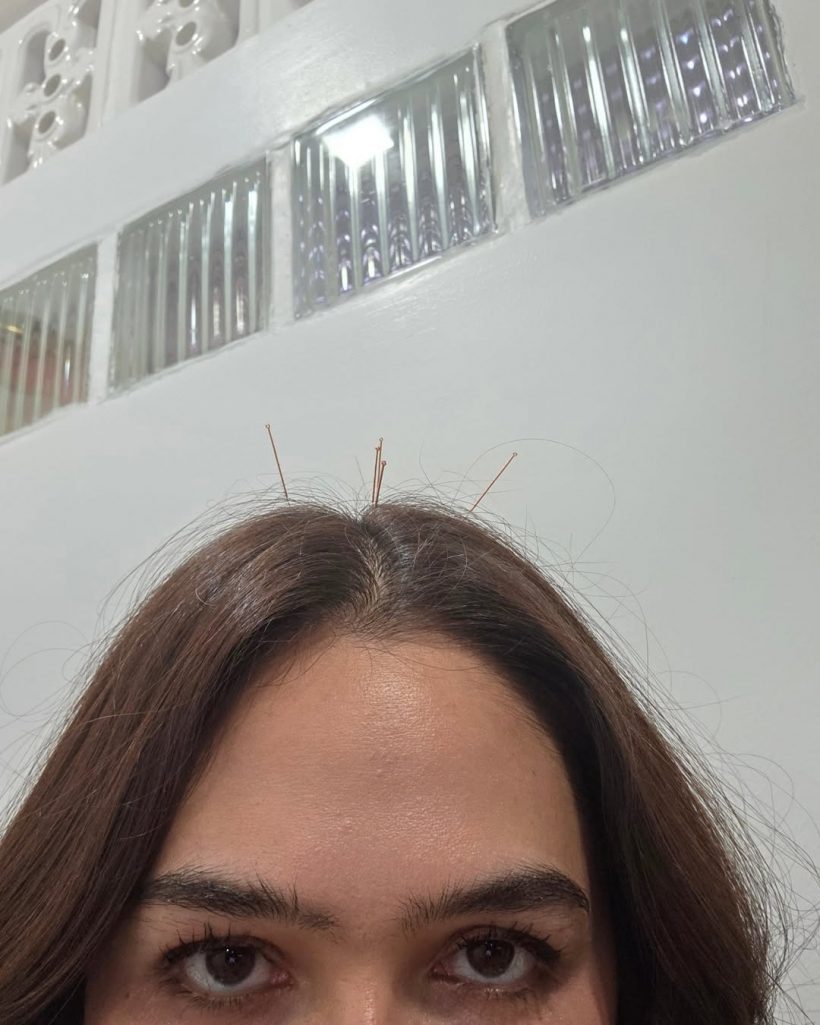 ภาพหายาก! ชมพู่ อารยา พบแพทย์แผนจีนแบบเรียบง่าย