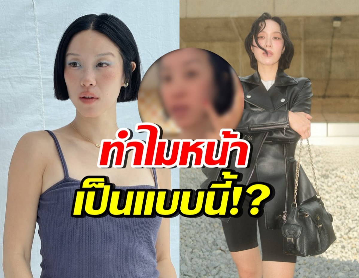 พลอย หอวัง เปิดหน้าสดล่าสุด แพ้อะไรมา ทำไมเป็นแบบนี้!?