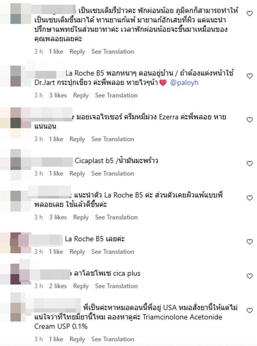 พลอย หอวัง เปิดหน้าสดล่าสุด แพ้อะไรมา ทำไมเป็นแบบนี้!?