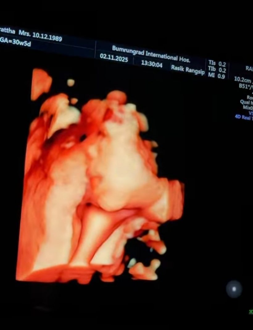 เนย วรัฐฐา เปิดหน้าลูกชาย หล่อออร่าแรงตั้งแต่ในท้อง