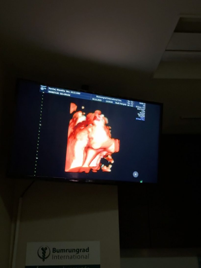 เนย วรัฐฐา เปิดหน้าลูกชาย หล่อออร่าแรงตั้งแต่ในท้อง