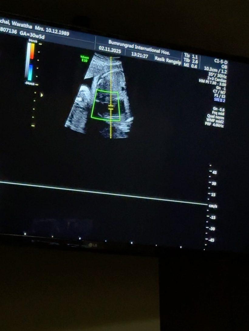 เนย วรัฐฐา เปิดหน้าลูกชาย หล่อออร่าแรงตั้งแต่ในท้อง