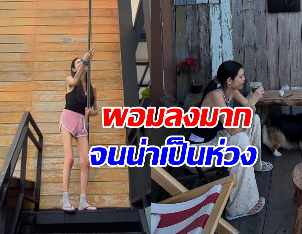 อัปเดตชีวิตล่าสุด เธอคนนี้ หลังทุกคนเป็นห่วง ผอมมาก