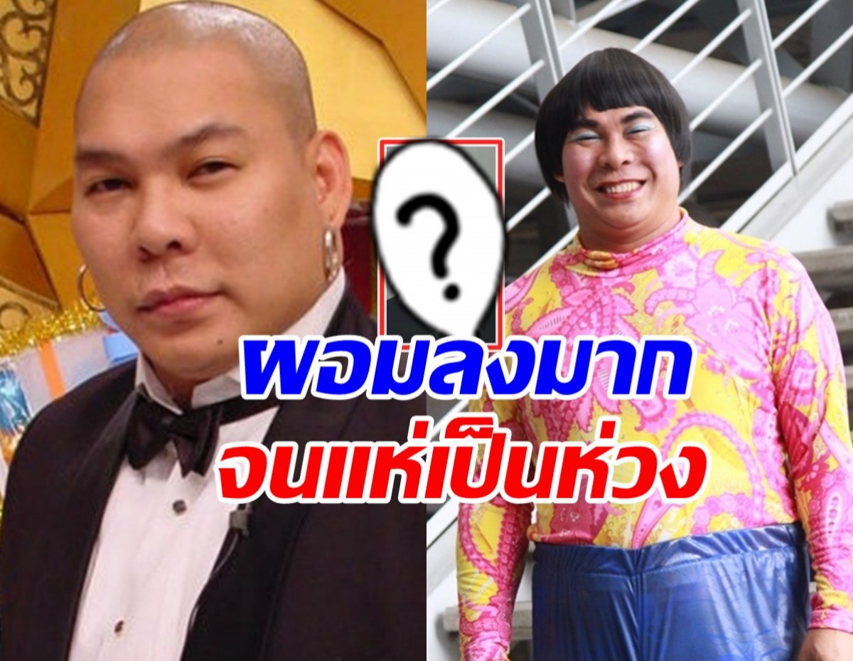ชาวเน็ตตกใจ! ห่วง โหน่ง ชะชะช่า ทำไมผอมลงขนาดนี้