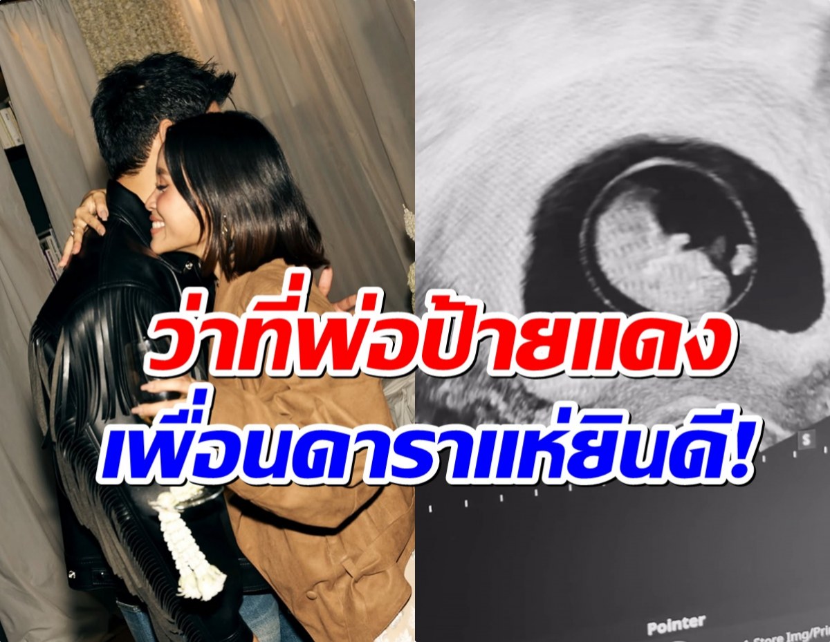 พระเอกดังประกาศข่าวดี ในที่สุดภรรยาตั้งท้องเล้ว!