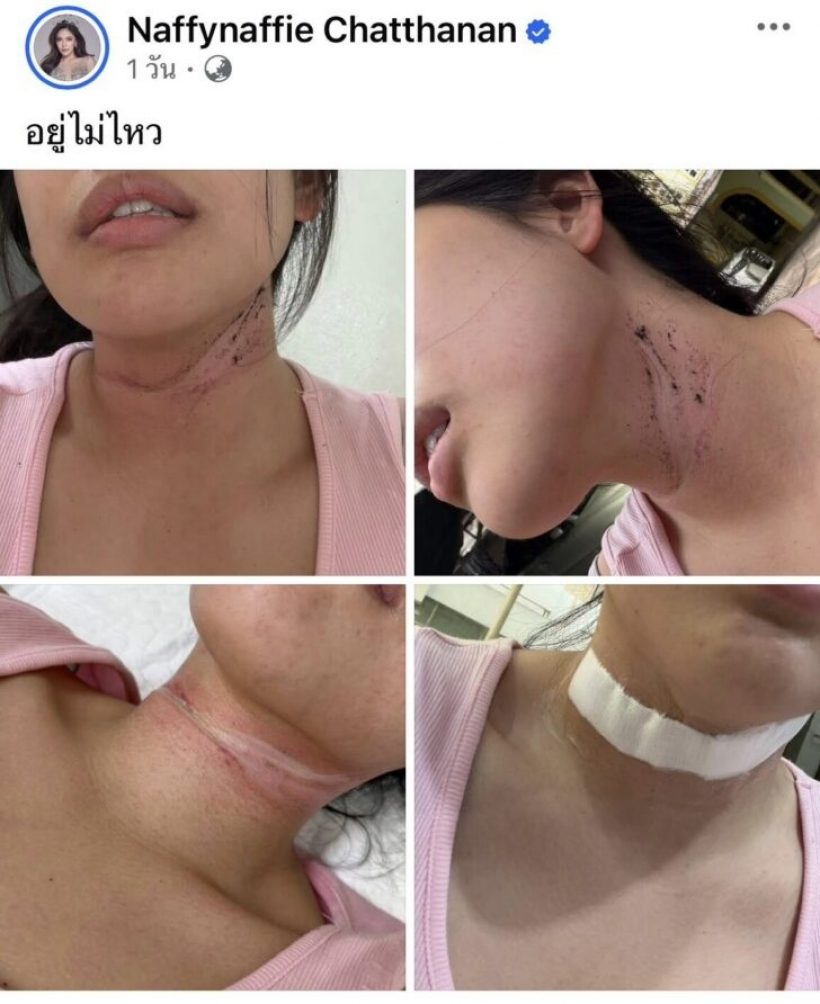 ระทึก! สาวคนดัง ถูกสายเคเบิลเกี่ยวคอ ถ้าเงยหน้า หักแน่นอน