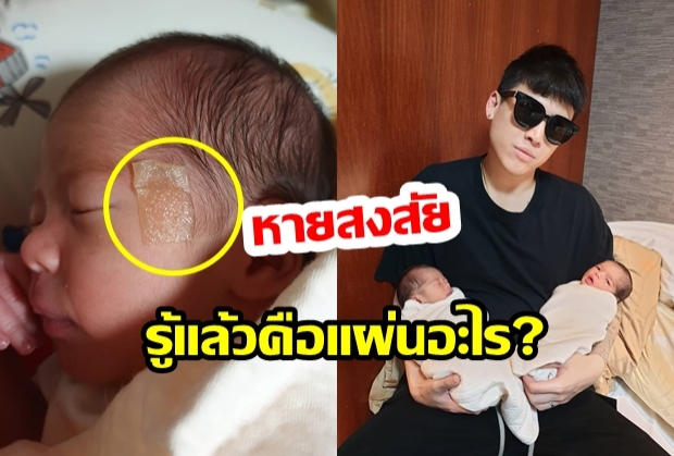 โอเคเคลียร์!..ในที่สุดก็ได้รู้ว่าแผ่นที่แปะหน้าน้องแฝด มิก้า-มิย่า คืออะไร หายสงสัยสักที!