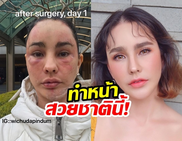 สวยกระชากวัย! แหม่ม วิชุดา รีวิวทำหน้าเกาหลี บอกเลยเป๊ะเว่อร์!