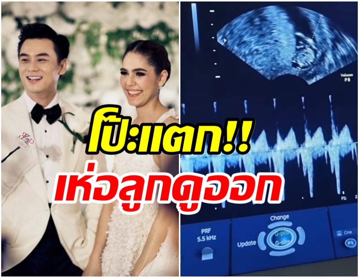 น็อต วิศรุต หลุดอีกเเล้วโดนชาวเน็ตจับโป๊ะเรื่องลูกคนที่3