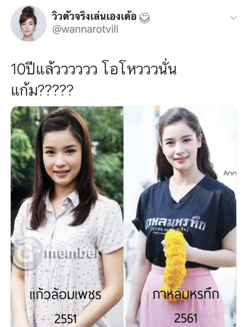 เปิดหน้าเก่า วิว วรรณรท สมัยเข้าวงการยังไม่รู้จักโบท็อกซ์