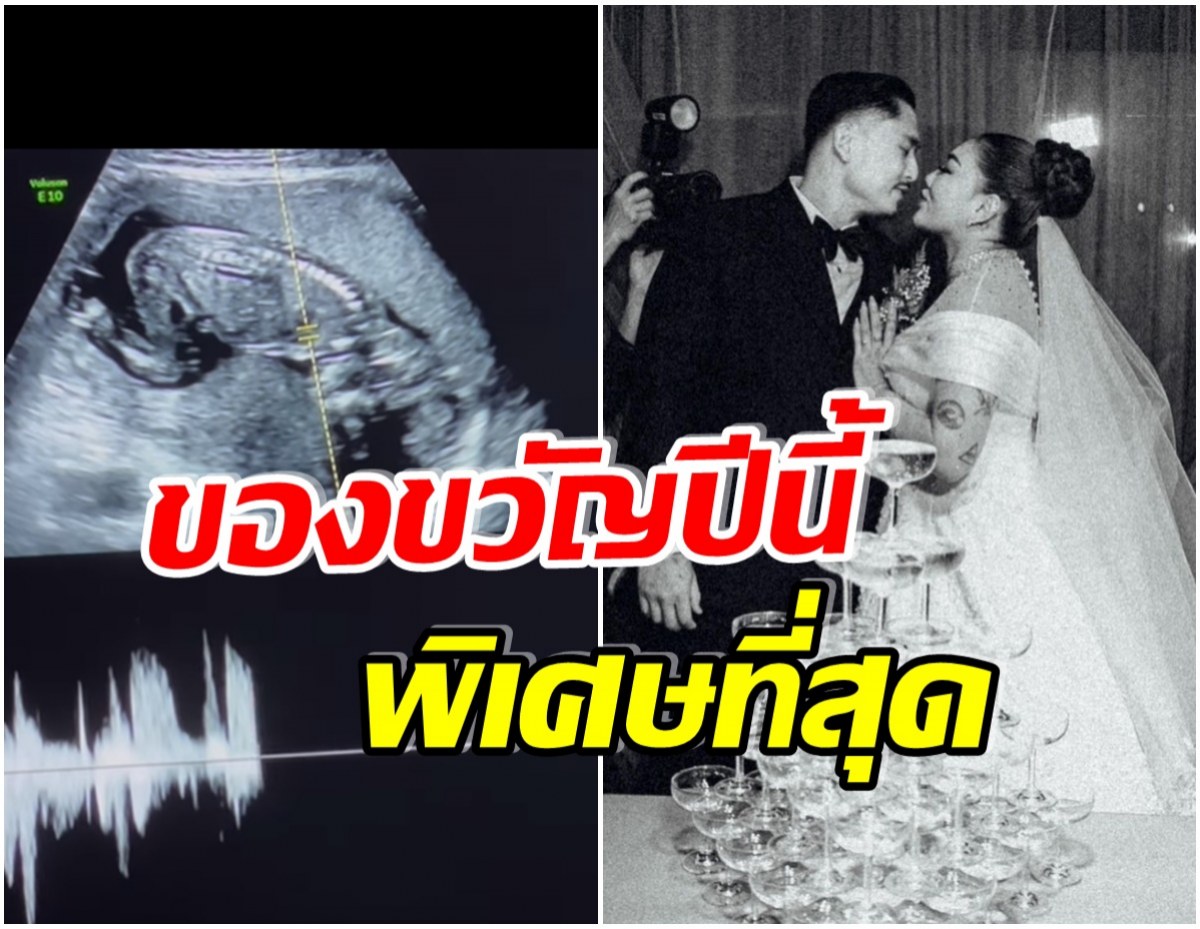 ว่าที่คุณเเม่! นักร้องสาวสุดฮ็อต ประกาศข่าวดี ท้องลูกคนเเรกเเล้ว