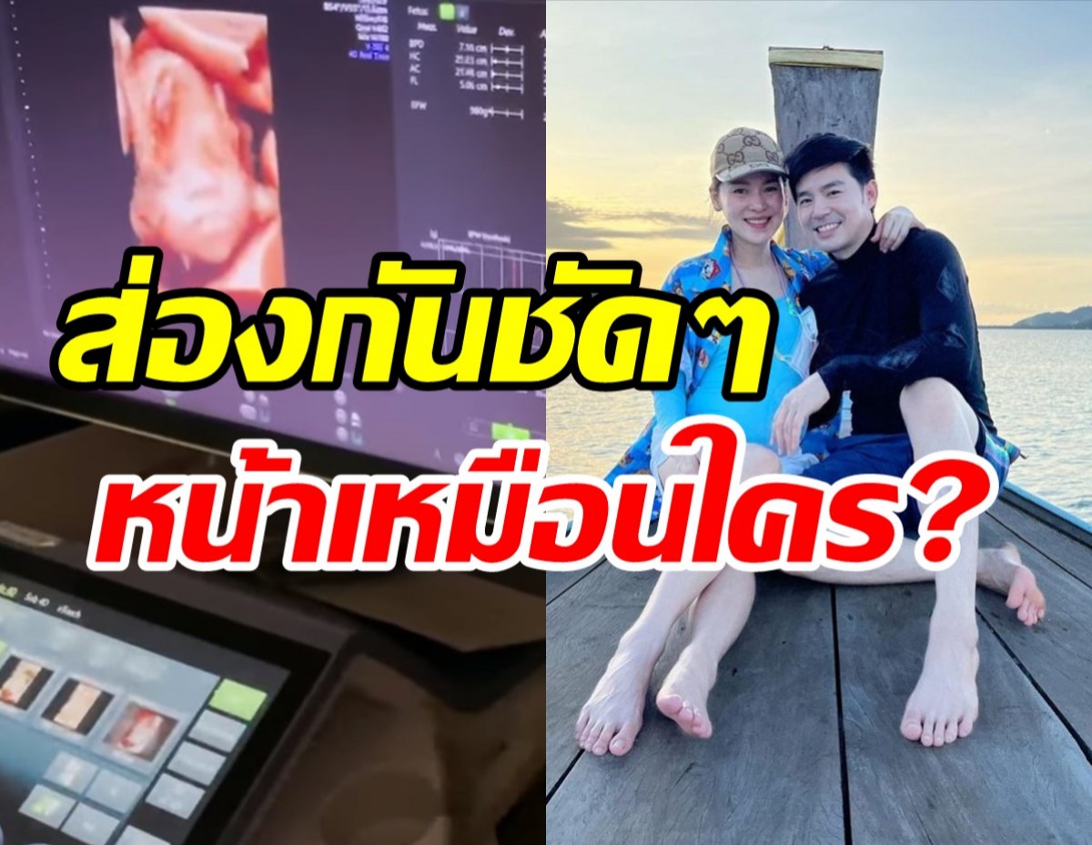  แอบส่อง2สาวฝาแฝดลูกบีม-ออย ดูกันชัดๆหน้าเหมือนคนนี้ที่สุด?