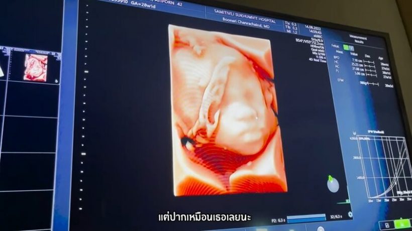  แอบส่อง2สาวฝาแฝดลูกบีม-ออย ดูกันชัดๆหน้าเหมือนคนนี้ที่สุด?