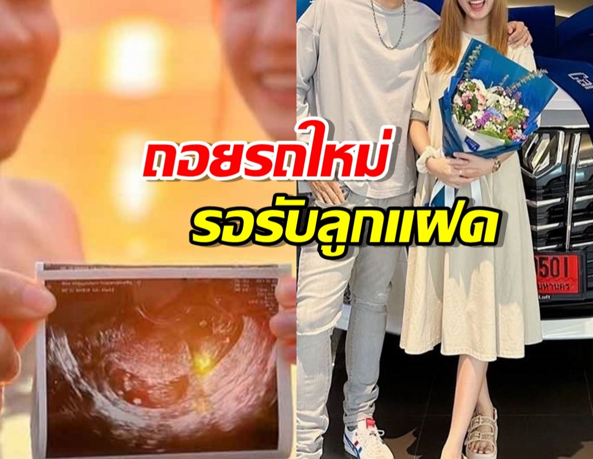 สุดปัง!ว่าที่พ่อแม่ป้ายแดงของวงการ ถอยรถใหม่ รอรับลูกแฝด