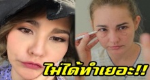 ไม่ได้ทำเยอะ!! “แหม่ม วิชุดา” เคลื่อนไหวแล้ว หลังบินไปอัพหน้าใหม่แล้วเจอดราม่า