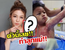 ฮารุ สุดห่วง ลูกชายน้องคิริน แพ้หนัก!ต้องแอดมิท เผยสาเหตุไว้เป็นอุทาหรณ์