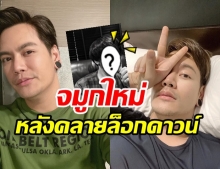 ยลโฉมจมูกใหม่ อ๊อฟ ปองศักดิ์ พุ่งปรี๊ด แม้ยังไม่เข้าที่