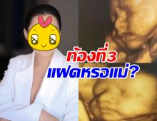 ชาวเน็ตตกใจภาพอัลตร้าซาวด์ลูกในท้อง ดาราดัง แฝดหรอ!?