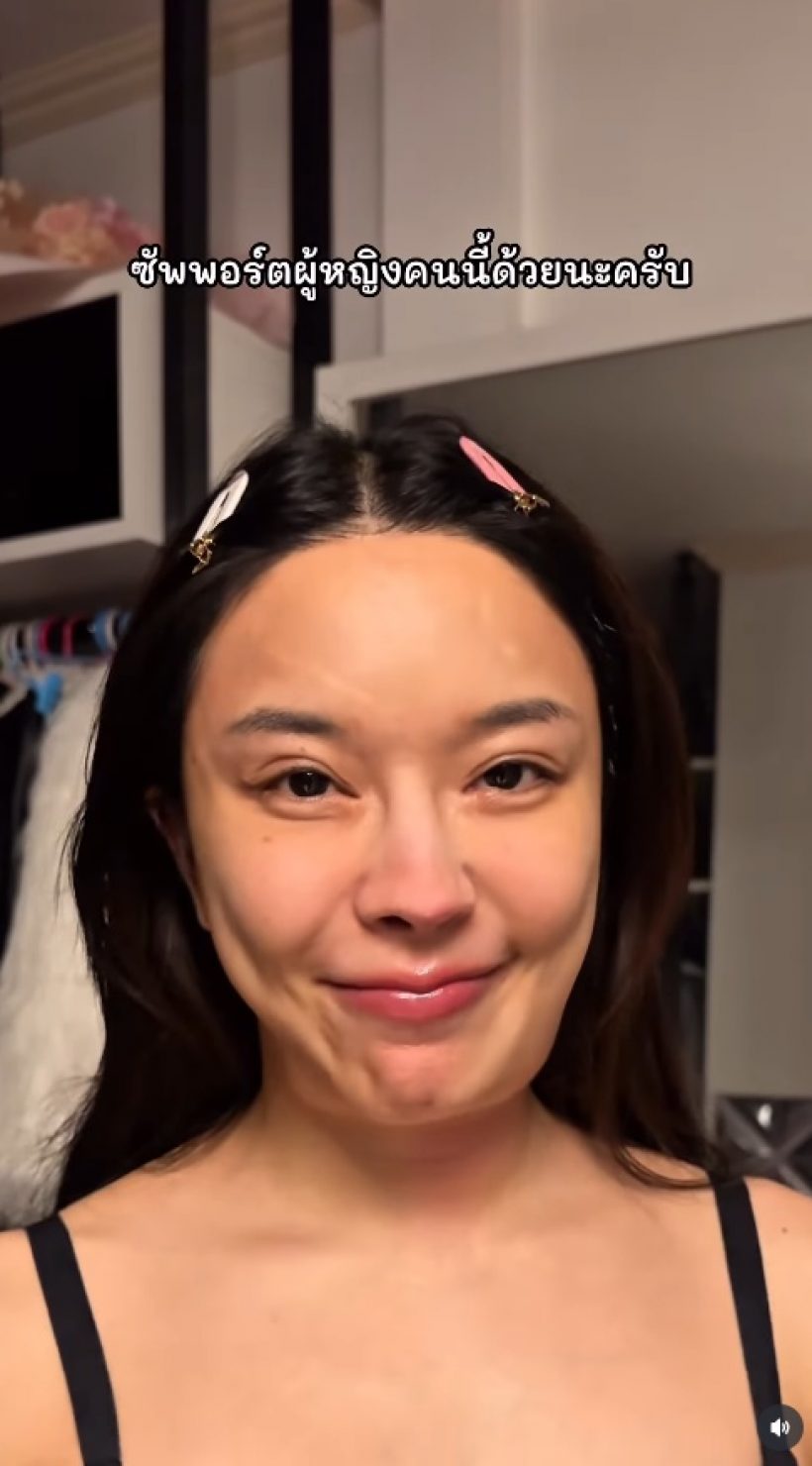 หญิงแย้คางบวม ถูกทักคล้ายมะเร็ง ล่าสุดหมอฟันธง เป็นอะไร?