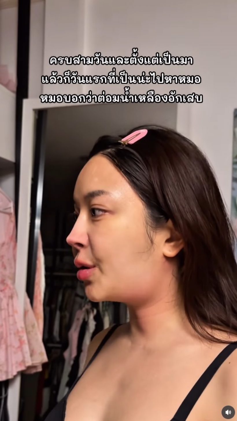 หญิงแย้คางบวม ถูกทักคล้ายมะเร็ง ล่าสุดหมอฟันธง เป็นอะไร?