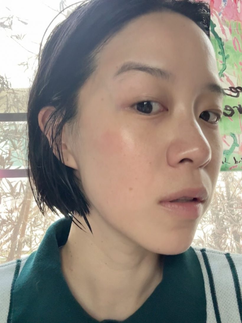 พลอย หอวัง พลีชีพเผยหน้าสด ผื่นขึ้นหน้าหนัก แต่ยังสวย!