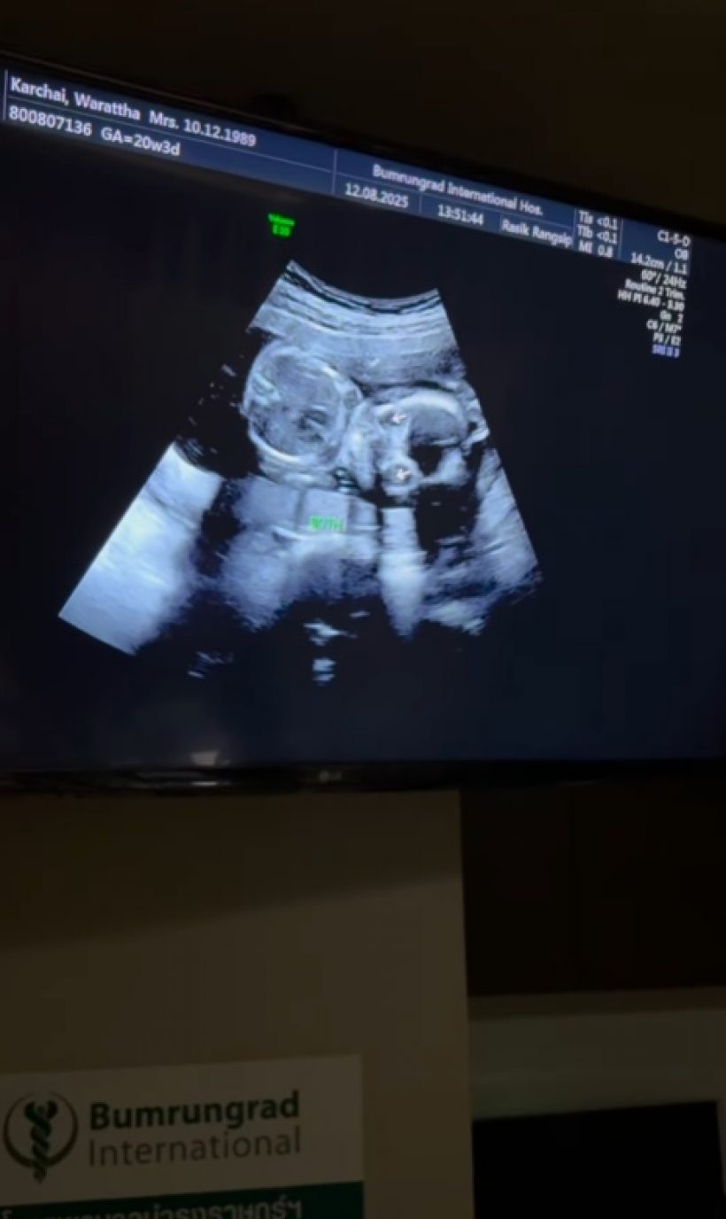 ทุกคนฟันธง! ลูกดาราสาวกับสามีคนนี้ หน้าตาดีชัวร์