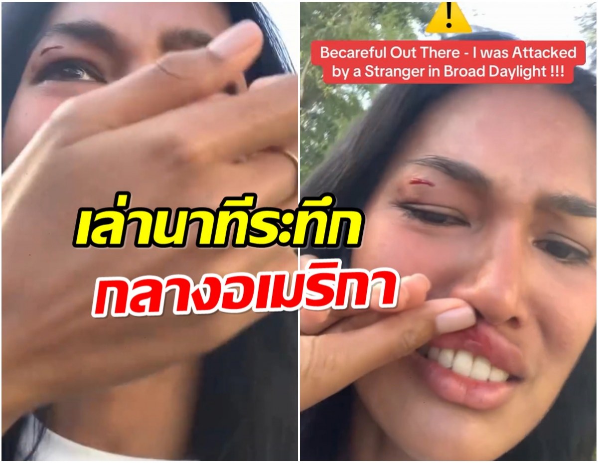 เดินอยู่ดีๆก็เจ็บฟรี! นางเเบบสาวไทย ถูกกระเป๋าฟาดหน้ากลางLA