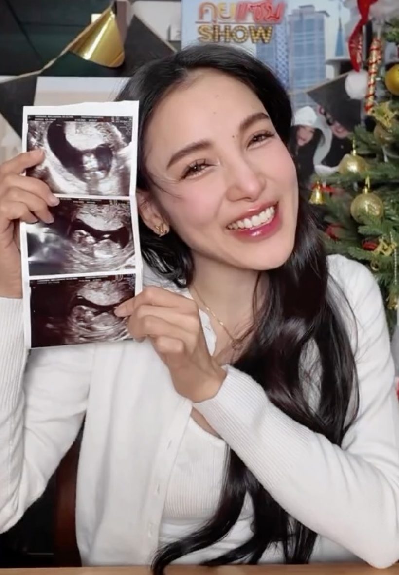 ดาราสาวดัง ประกาศท้องแล้ว พร้อมทำงานยาวจนวันคลอด