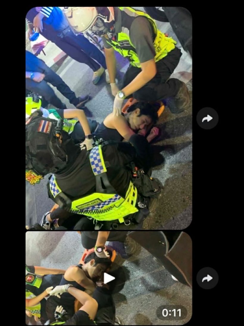 สุดห่วง ดาราดังถูกรถชนคาทางม้าลาย ต้องใส่เหล็กตลอดชีวิต