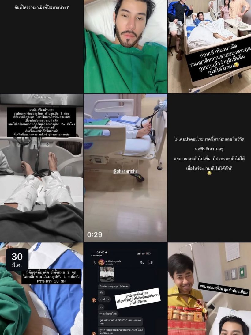 สุดห่วง ดาราดังถูกรถชนคาทางม้าลาย ต้องใส่เหล็กตลอดชีวิต