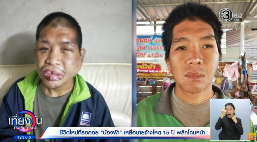 ภาพหล่อน้องฟ้าAI พร้อมเปิดหน้าจริงหลังศัลย์