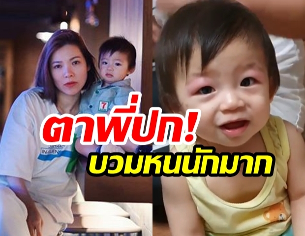 ชาวเน็ตแห่เป็นห่วง! หลัง “ดีเจต้นหอม” เผยอาการ! “น้องปกป้อง” ตาบวมตุ่ย 