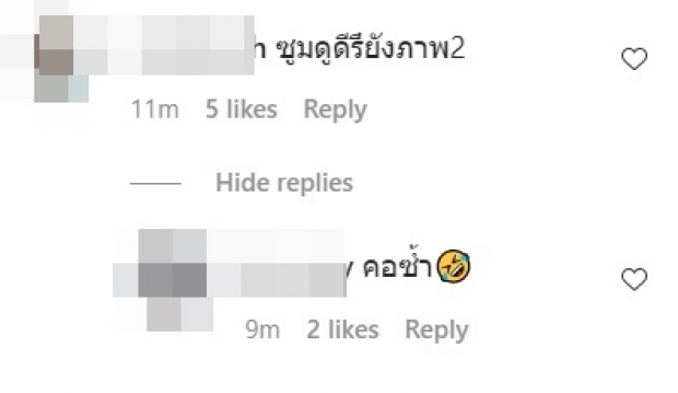 ชาวเน็ตขี้สงสัย! เเเห่ถาม เเต้ว เเขน-คอ เขียวช้ำ ไปโดนอะไรมา 