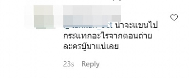 ชาวเน็ตขี้สงสัย! เเเห่ถาม เเต้ว เเขน-คอ เขียวช้ำ ไปโดนอะไรมา 