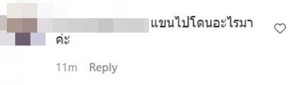 ชาวเน็ตขี้สงสัย! เเเห่ถาม เเต้ว เเขน-คอ เขียวช้ำ ไปโดนอะไรมา 