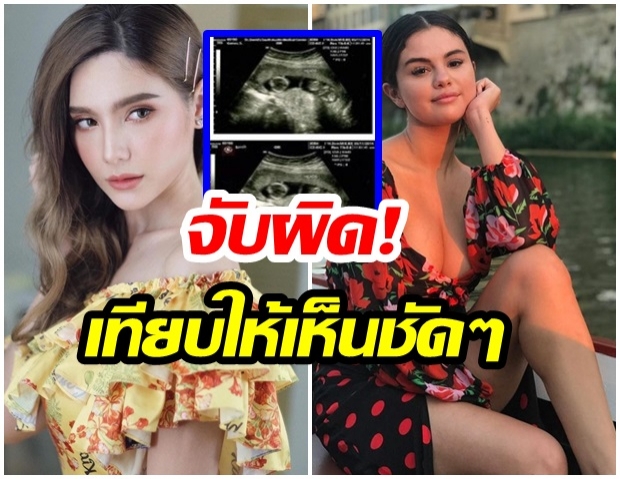  ซาร่า โป๊ะอีกแล้ว! ภาพอัลตร้าซาวด์ทำไม เหมือนของ เซเลน่า  โกเมซ