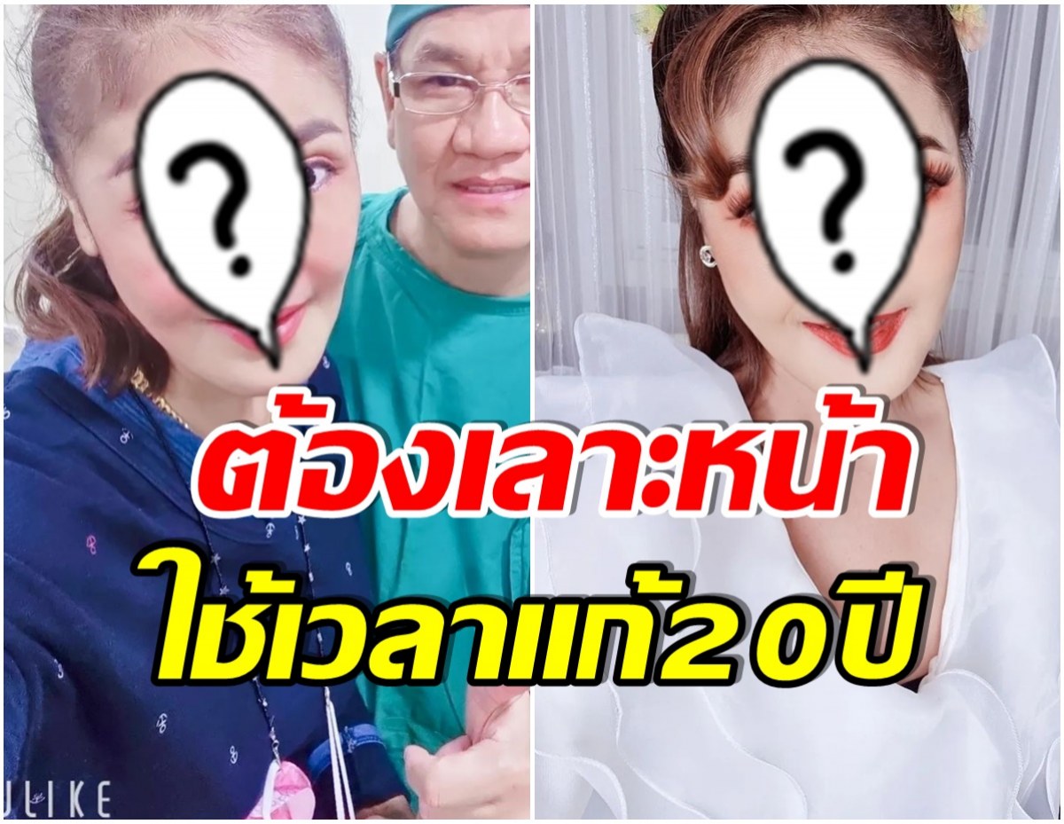 นักร้องสาวเล่าความทุกข์ใจ 20 ปี หลังเจอพิษศัลยกรรม โดนบูลลี่หนัก