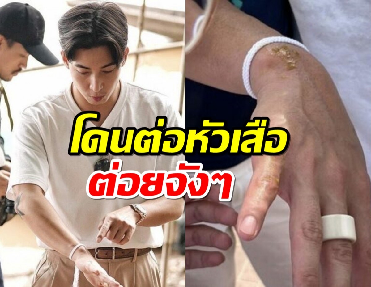 ตกใจเลย โตโน่ เตรียมว่ายน้ำข้ามโขง ล่าสุดโดนต่อหัวเสือต่อย 