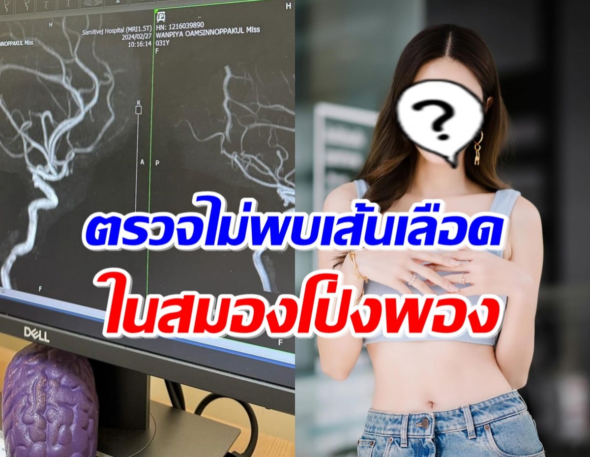 ดาราสาวโล่งใจ ตรวจไม่พบเส้นเลือดในสมองโป่งพอง